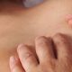 Mani di fisioterapista che eseguono un massaggio